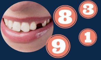 Mơ thấy răng đánh xổ số gì